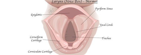 laryngitis diagram